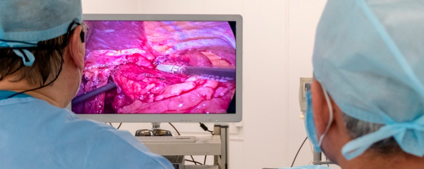 Cirurgia da Obesidade